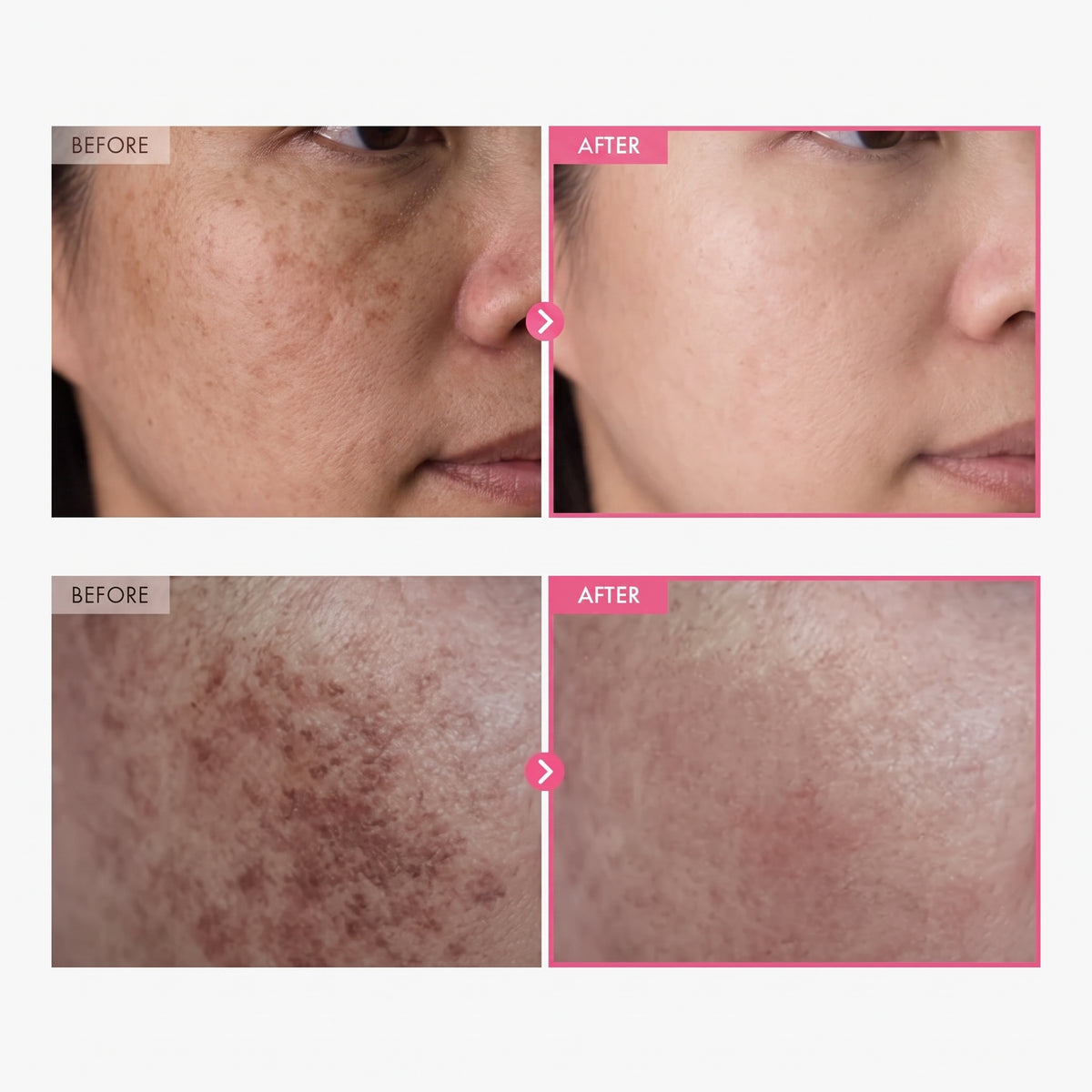 Korean Advanced Brightening cream